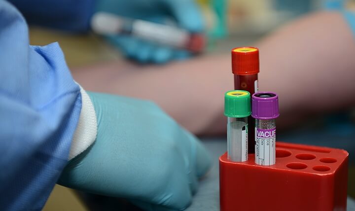 Testosterone for heart arteries